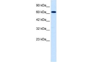 Western Blotting (WB) image for anti-Sodium Channel, Nonvoltage-Gated 1, beta (SCNN1B) antibody (ABIN2461078) (SCNN1B Antikörper)