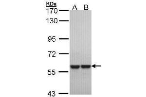 WB Image Sample (30 ug of whole cell lysate) A: Hela B: Hep G2 , 7. (MUTYH Antikörper  (Center))