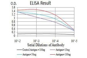 Black line: Control Antigen (100 ng),Purple line: Antigen (10 ng), Blue line: Antigen (50 ng), Red line:Antigen (100 ng) (AEBP2 Antikörper  (AA 358-495))