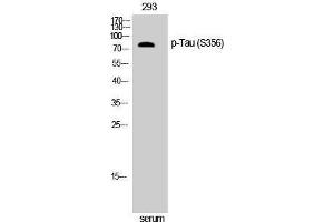 Western Blotting (WB) image for anti-tau Protein (pSer356) antibody (ABIN3182161) (tau Antikörper  (pSer356))