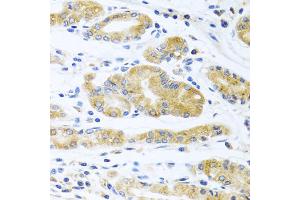 Immunohistochemistry of paraffin-embedded human stomach using ApoE antibody (ABIN5975768) at dilution of 1/100 (40x lens). (APOE Antikörper)