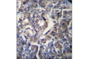 Immunohistochemistry analysis in Formalin Fixed, Paraffin Embedded Human pancreas tissue using RPL35 Antibody (C-term) followed by peroxidase conjugation of the secondary antibody and DAB staining.