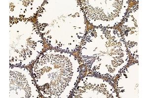 ABIN7096241 and ABIN7100303 at 1/100 staining rat testis tissue by IHC-P. (SAMD3 Antikörper)