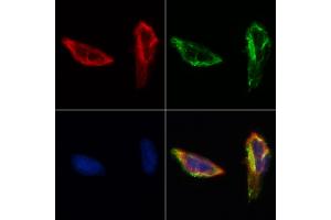 ABIN6261894 and ABIN6268716 staining Hela by IF/ICC. (GATA5 Antikörper  (Internal Region))