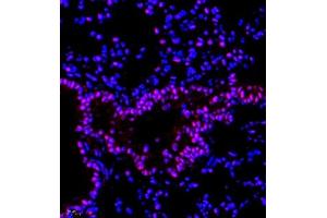 Immunofluorescence of paraffin embedded mouse lung using RBAK (ABIN7075383) at dilution of 1:400 (400x lens)