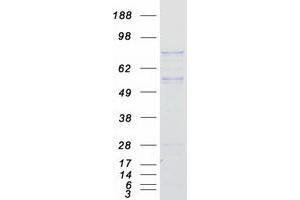 Validation with Western Blot (FYB Protein (Transcript Variant 2) (Myc-DYKDDDDK Tag))