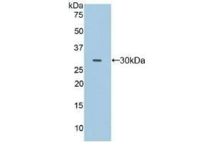 Detection of Recombinant FcgRII, Human using Polyclonal Antibody to Cluster Of Differentiation 32 (CD32) (Fc gamma RII (CD32) (AA 69-309) Antikörper)