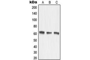 Western blot analysis of MMP15 expression in HeLa (A), mouse kidney (B), rat kidney (C) whole cell lysates. (MMP15 Antikörper  (Center))
