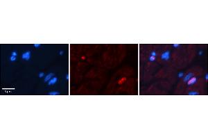 Rabbit Anti-Dpf3 Antibody  Catalog Number: ARP38943_P050 Formalin Fixed Paraffin Embedded Tissue: Human Adult heart  Observed Staining: Nuclear (not in cardiomyocytes but in fibrocytes in endomysium Primary Antibody Concentration: 1:600 Secondary Antibody: Donkey anti-Rabbit-Cy2/3 Secondary Antibody Concentration: 1:200 Magnification: 20X Exposure Time: 0. (DPF3 Antikörper  (N-Term))