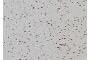 ABIN6266296 and ABIN6277446 at 1/100 staining Rat heart tissue by IHC-P. (INA Antikörper  (Internal Region))