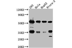 Western Blot Positive WB detected in: 293 whole cell lysate, Hela whole cell lysate, HepG2 whole cell lysate, Ntera-2 whole cell lysate All lanes: NONO Antibody at 1:1000 Secondary Goat polyclonal to rabbit IgG at 1/50000 dilution Predicted band size: 55, 44 kDa Observed band size: 55 kDa (Rekombinanter NONO Antikörper)