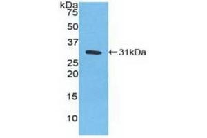 Detection of Recombinant CA3, Human using Polyclonal Antibody to Carbonic Anhydrase III, Muscle Specific (CA3) (CA3 Antikörper  (AA 2-260))