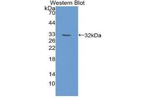 Western Blotting (WB) image for anti-Inter-alpha Globulin Inhibitor H2 Polypeptide (ITIH2) (AA 452-702) antibody (ABIN1868779) (ITIH2 Antikörper  (AA 452-702))