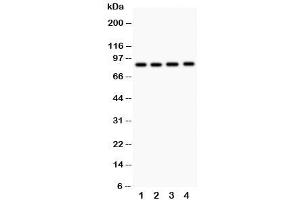 Western blot testing of NOX5 antibody and  Lane 1: 22RV1 (NOX5 Antikörper  (C-Term))