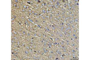 IHC analysis of Septin 3/SEPTIN3 using anti-Septin 3/SEPTIN3 antibody (ABIN7599288).