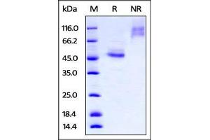 Biotinylated Human TIGIT, Fc Tag on SDS-PAGE under reducing (R) and no-reducing (NR) conditions. (TIGIT Protein (AA 22-141) (Fc Tag,AVI tag,Biotin))