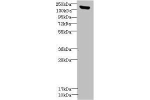 Western blot All lanes: CNTNAP1antibody IgG at 1. (CNTNAP1 Antikörper  (AA 20-300))