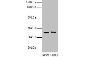 Western blot All lanes: Cd82 antibody at 2 μg/mL Lane 1: Jurkat whole cell lysate Lane 2: A549 whole cell lysate Secondary Goat polyclonal to rabbit IgG at 1/10000 dilution Predicted band size: 30 kDa Observed band size: 30 kDa (CD82 Antikörper  (AA 111-227))