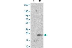 Western blot analysis of Lane 1: Negative control (vector only transfected HEK293T lysate). (TRAPPC6A Antikörper)
