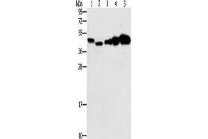 Gel: 10 % SDS-PAGE, Lysate: 40 μg, Lane 1-5: Hela cells, Raji cells, Jurkat cells, A549 cells, NIH/3T3 cells, Primary antibody: ABIN7130674(PPAT Antibody) at dilution 1/250, Secondary antibody: Goat anti rabbit IgG at 1/8000 dilution, Exposure time: 20 seconds