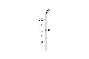 Western blot analysis of lysate from A431 cell line, using COL6A1 Antibody at 1:1000. (COL6A1 Antikörper  (C-Term))