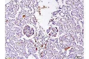 Formalin-fixed and paraffin embedded rat nephroblastoma labeled with Anti SET Polyclonal Antibody, Unconjugated (ABIN760166) at 1:200 followed by conjugation to the secondary antibody and DAB staining (SET/TAF-I Antikörper)
