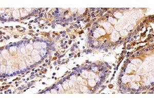 Immunohistochemistry (IHC) image for anti-Cathepsin S (CTSS) (AA 115-331) antibody (ABIN7434368)