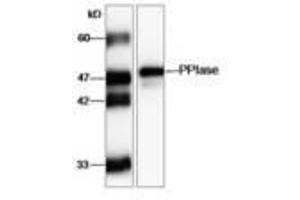 Image no. 1 for anti-FK506 Binding Protein 11, 19 KDa (FKBP11) (AA 28-201) antibody (ABIN791454) (FKBP11 Antikörper  (AA 28-201))