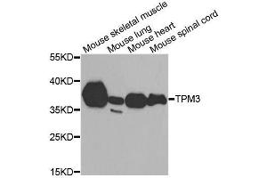 Western blot analysis of extracts of various cell lines, using TPM3 antibody. (TPM3 Antikörper  (AA 1-284))