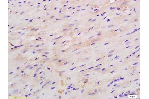 Formalin-fixed and paraffin embedded mouse heart labeled with Rabbit Anti H Cadherin/T cadherin Polyclonal Antibody, Unconjugated (ABIN715271) at 1:200 followed by conjugation to the secondary antibody and DAB staining (Cadherin 13 Antikörper  (AA 301-400))