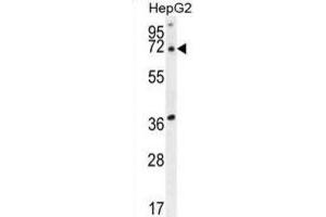 Western Blotting (WB) image for anti-Acyl-CoA Thioesterase 11 (ACOT11) antibody (ABIN2995532) (ACOT11 Antikörper)