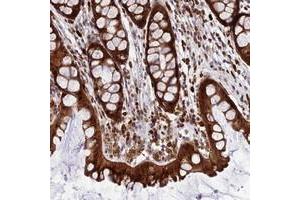 Immunohistochemical staining of human colon with JSRP1 polyclonal antibody  shows strong cytoplasmic and nuclear positivity in glandular cells. (JSRP1 Antikörper)