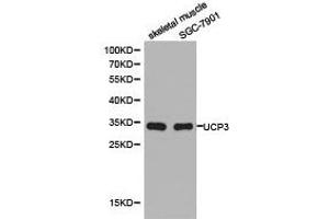 Western Blotting (WB) image for anti-Uncoupling Protein 3 (Mitochondrial, Proton Carrier) (UCP3) antibody (ABIN1875270) (UCP3 Antikörper)