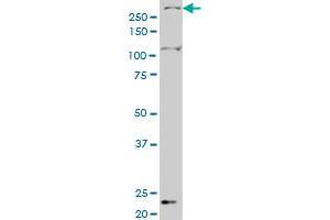 SMG1 monoclonal antibody (M03), clone 1C12 Western Blot analysis of SMG1 expression in Hela S3 NE . (SMG1 Antikörper  (AA 2922-3031))