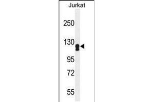 Western blot analysis in Jurkat cell line lysates (35ug/lane). (ADCY2 Antikörper  (AA 451-481))