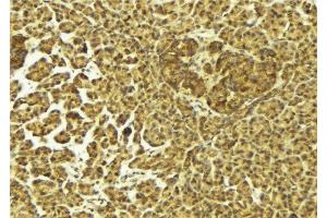 ABIN6275418 at 1/100 staining Mouse pancreas tissue by IHC-P. (S100A16 Antikörper  (Internal Region))