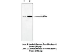 Image no. 1 for anti-Cannabinoid Receptor 2 (CNR2) (AA 20-33) antibody (ABIN1491167) (CNR2 Antikörper  (AA 20-33))