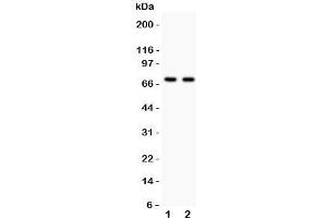 Western blot testing of SHBG antibody and Lane 1:  HeLa;  2: COLO320;  Predicted size per AA content: 44KD, but this highly glycosylated protein is observed up to 100KD (SHBG Antikörper  (AA 30-210))
