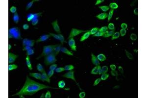 Immunofluorescence staining of SH-SY5Y cells with ABIN7155933 at 1:100, counter-stained with DAPI. (HAP1 Antikörper  (AA 328-580))