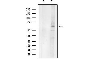 anti-gamma-aminobutyric Acid (GABA) A Receptor, beta 2 (GABRB2) (N-Term) antibody