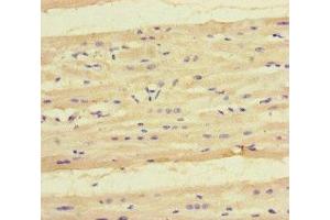 Immunohistochemistry of paraffin-embedded human heart tissue using ABIN7157751 at dilution of 1:100 (KYNU Antikörper  (AA 99-214))