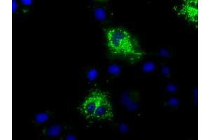 Image no. 1 for anti-Mitochondrial Translational Release Factor 1-Like (MTRF1L) antibody (ABIN1498694)