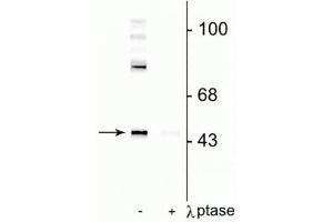 Western blot of rat cortical lysate showing specific immunolabeling of the ~50 kDa Gap-43 protein phosphorylated at Ser41 in the first lane (-). (GAP43 Antikörper  (pSer41))