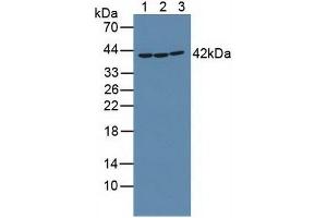 Figure. (RIPK2 Antikörper  (AA 432-540))