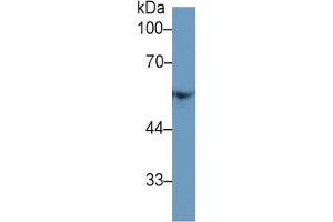 Western Blotting (WB) image for Fibrinogen beta Chain (FGB) ELISA Kit (ABIN6574262)