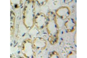 Immunohistochemistry (IHC) image for anti-Nephrosis 1, Congenital, Finnish Type (Nephrin) (NPHS1) (AA 39-106) antibody (ABIN1860040)