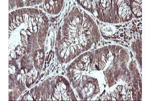 Image no. 4 for anti-Cell Division Cycle 123 Homolog (CDC123) antibody (ABIN1497388)