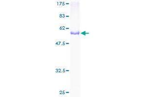 CCRK Protein (AA 1-275) (GST tag)