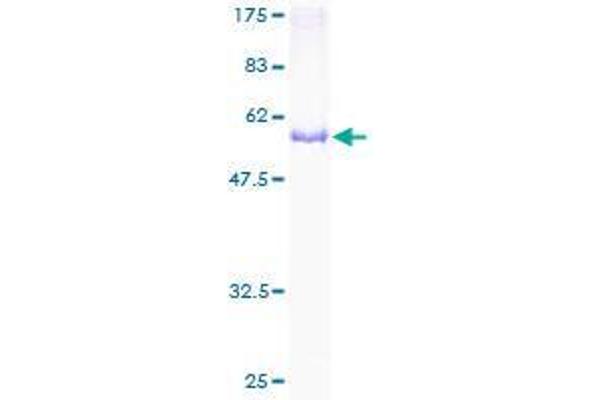 CCRK Protein (AA 1-275) (GST tag)