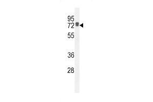 LRC40 Antibody (C-term) (ABIN654977 and ABIN2844617) western blot analysis in HepG2 cell line lysates (35 μg/lane). (LRRC40 Antikörper  (C-Term))